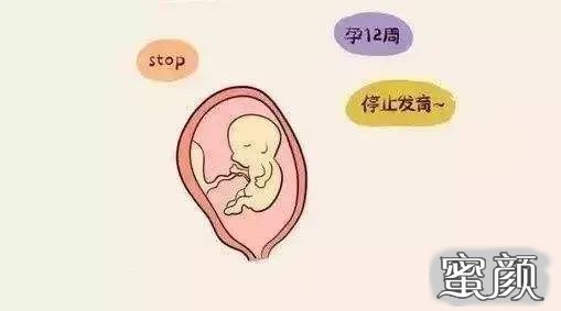 https://img.yiyiaimei.com/mnt/timg/200717/1242531N0-0.jpg 案例图片