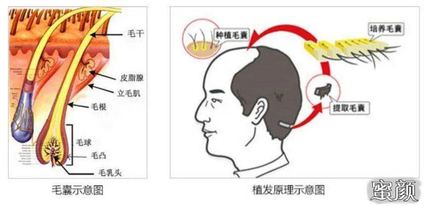 案例图片