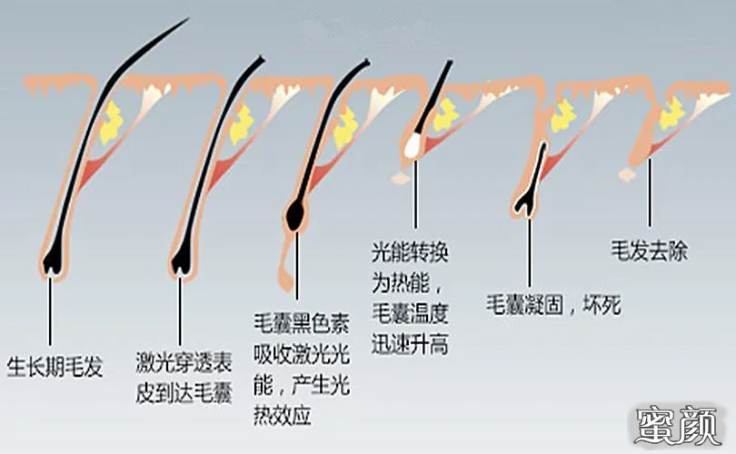 案例图片