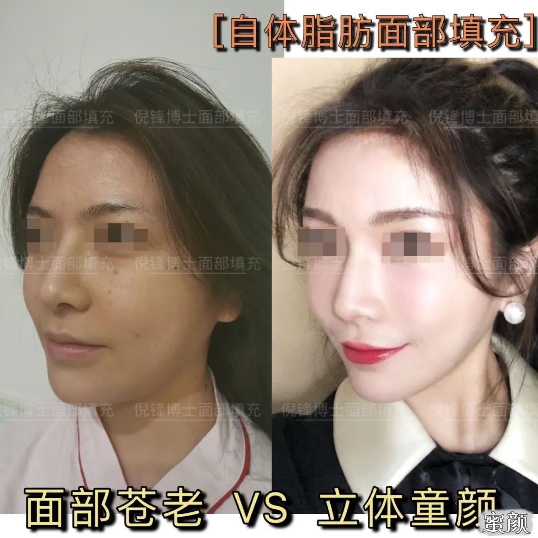 https://img.yiyiaimei.com/mnt/timg/200718/1139353a0-1.jpg 案例图片