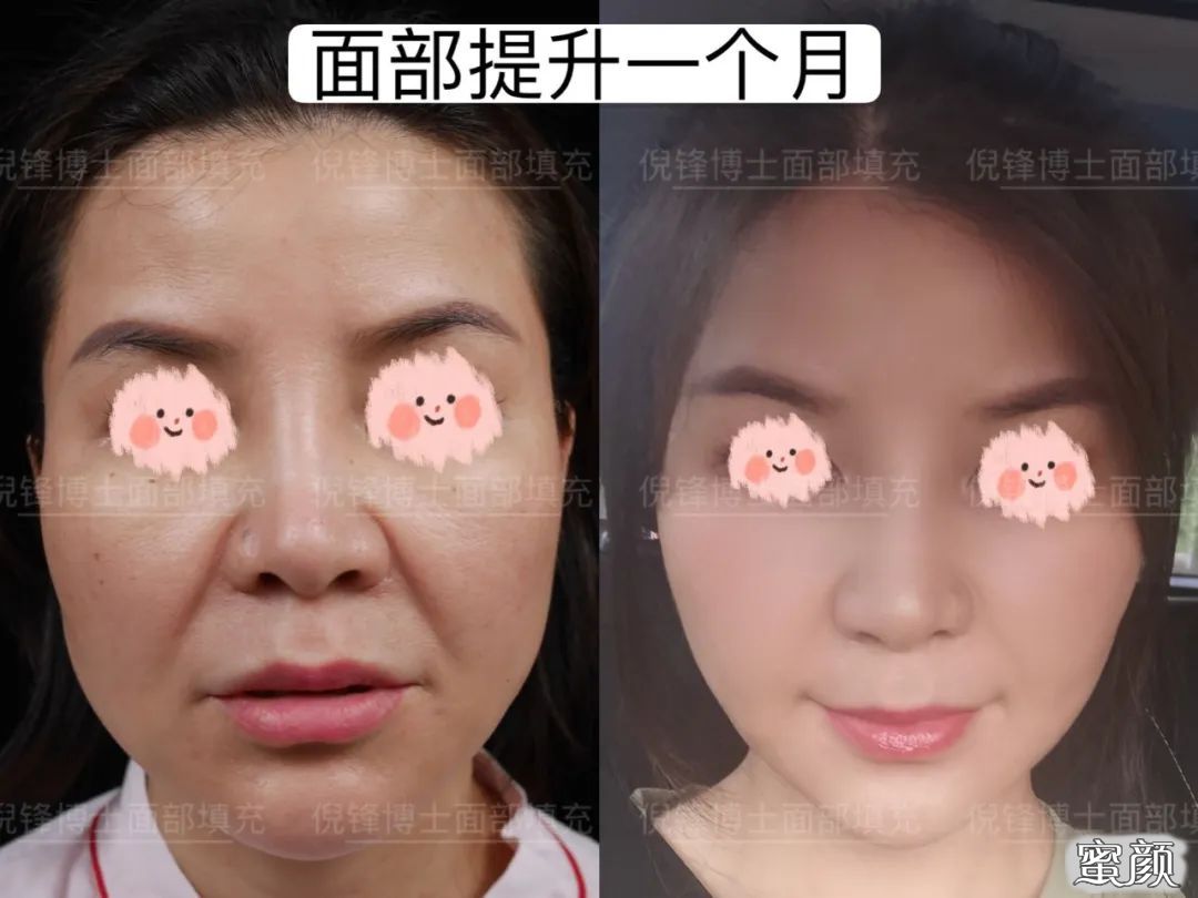 https://img.yiyiaimei.com/mnt/timg/200718/11393914b-4.jpg 案例图片