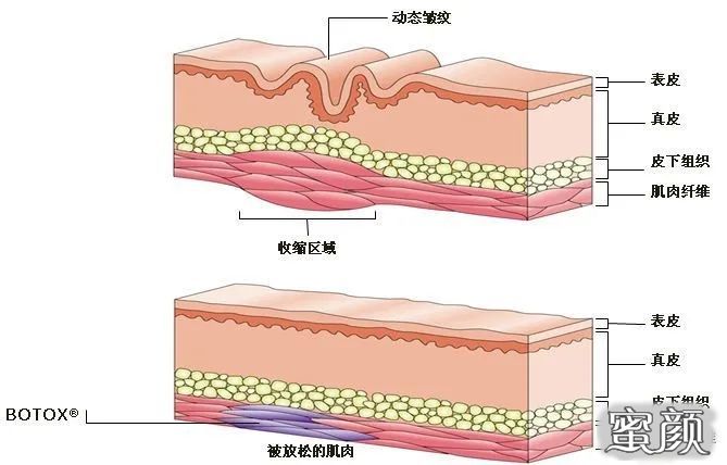 案例图片