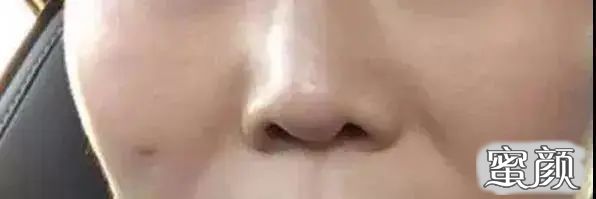 https://img.yiyiaimei.com/mnt/timg/200719/1416342303-0.jpg