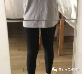 案例图片