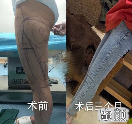 案例图片