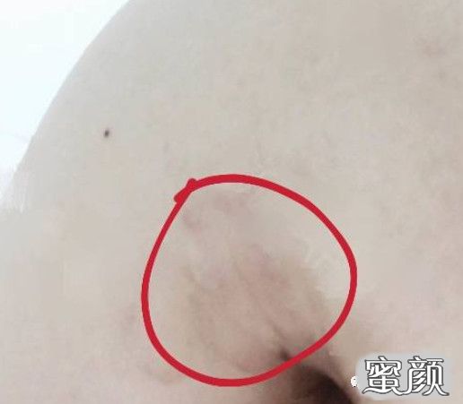 案例图片