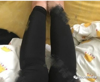 案例图片