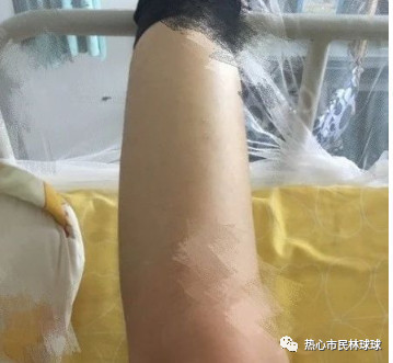 案例图片