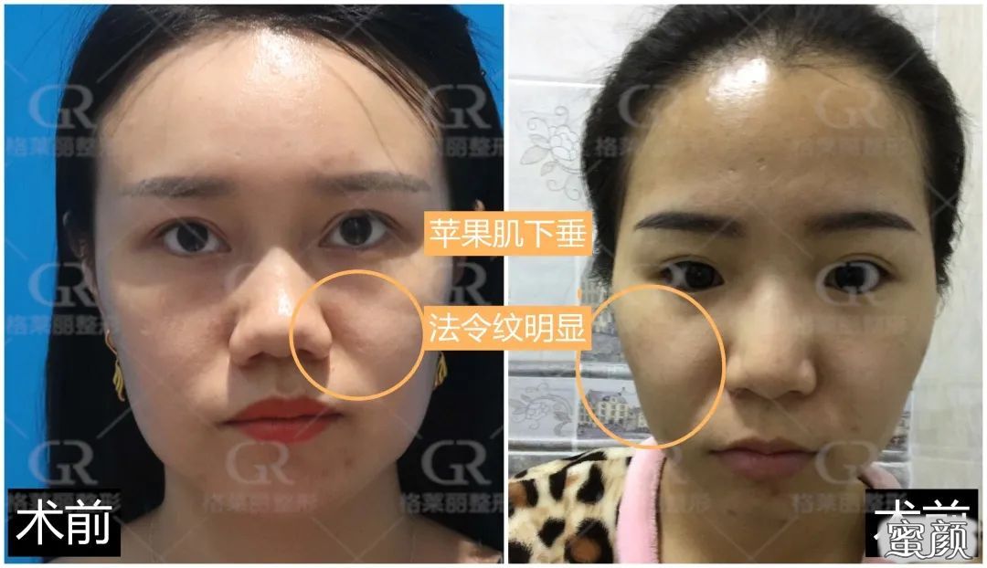 https://img.yiyiaimei.com/mnt/timg/200720/1202533113-8.jpg