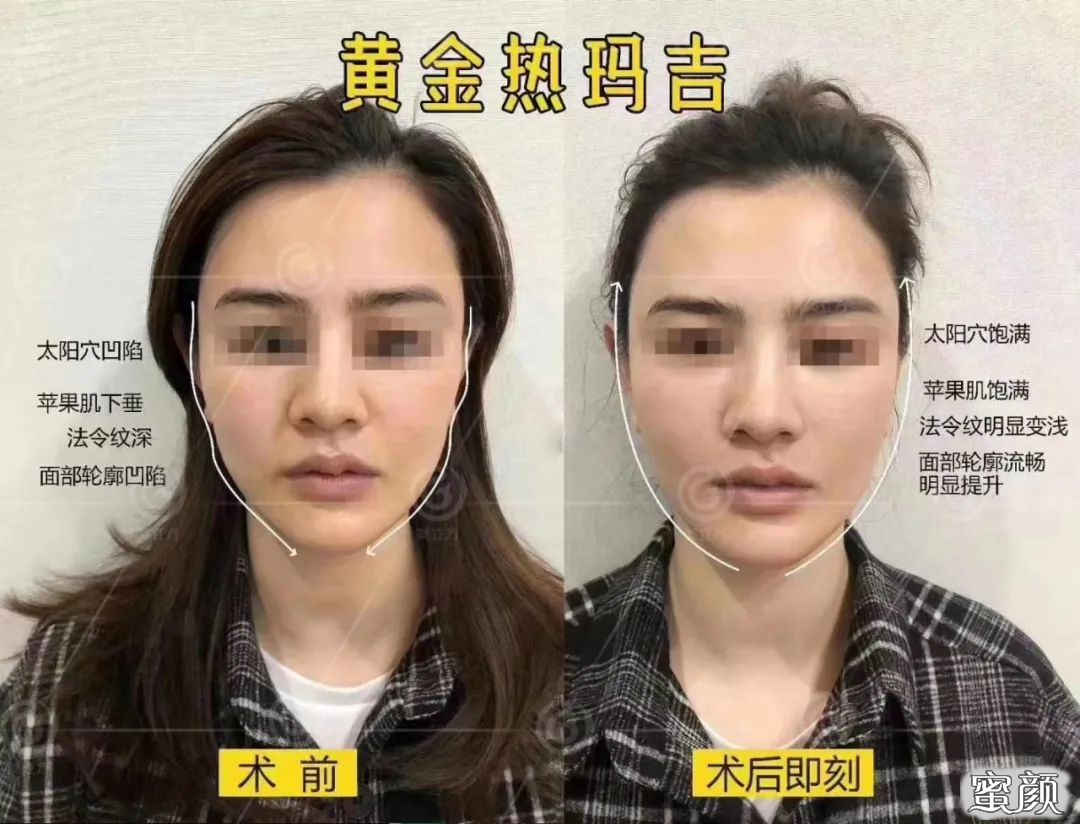 https://img.yiyiaimei.com/mnt/timg/200721/1130291H5-13.jpg