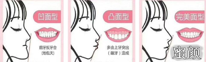 案例图片