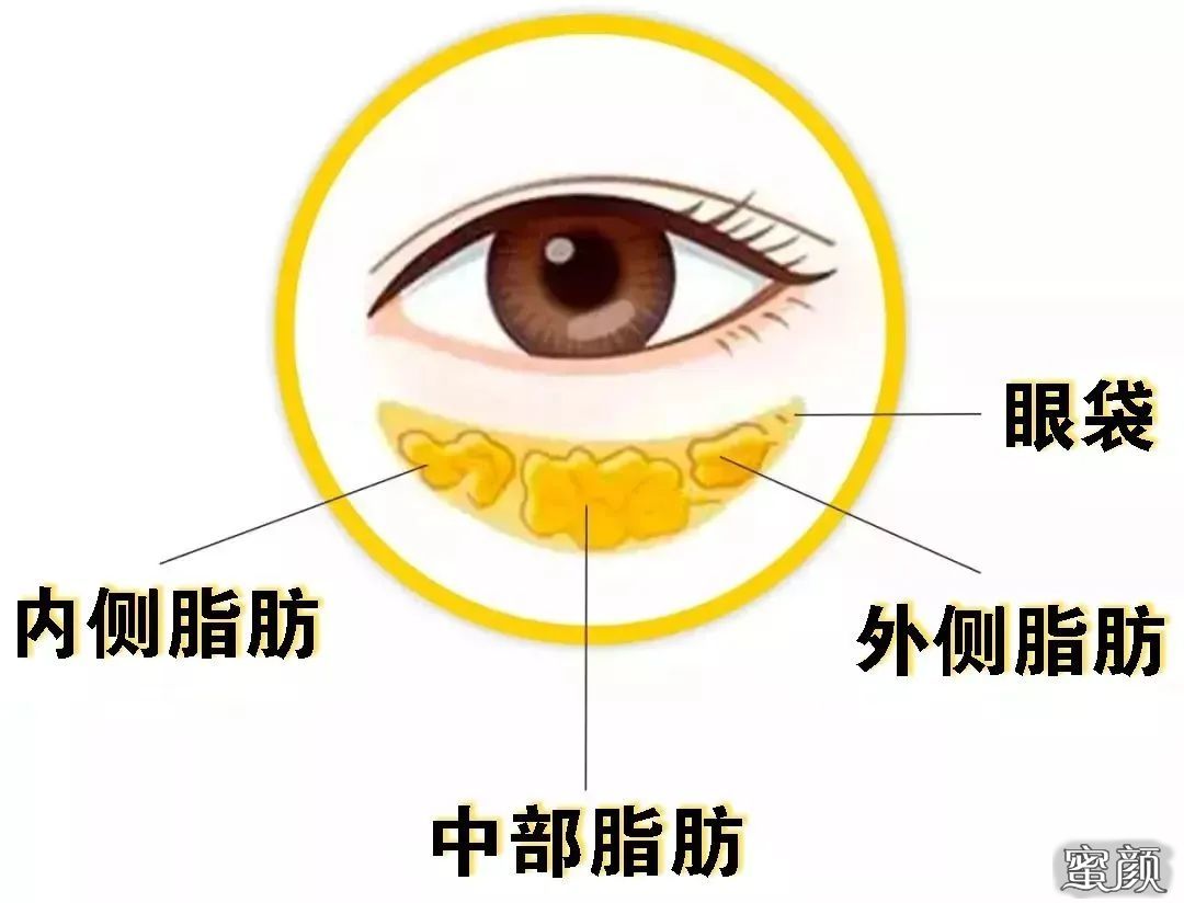 https://img.yiyiaimei.com/mnt/timg/200722/131Q05400-5.jpg