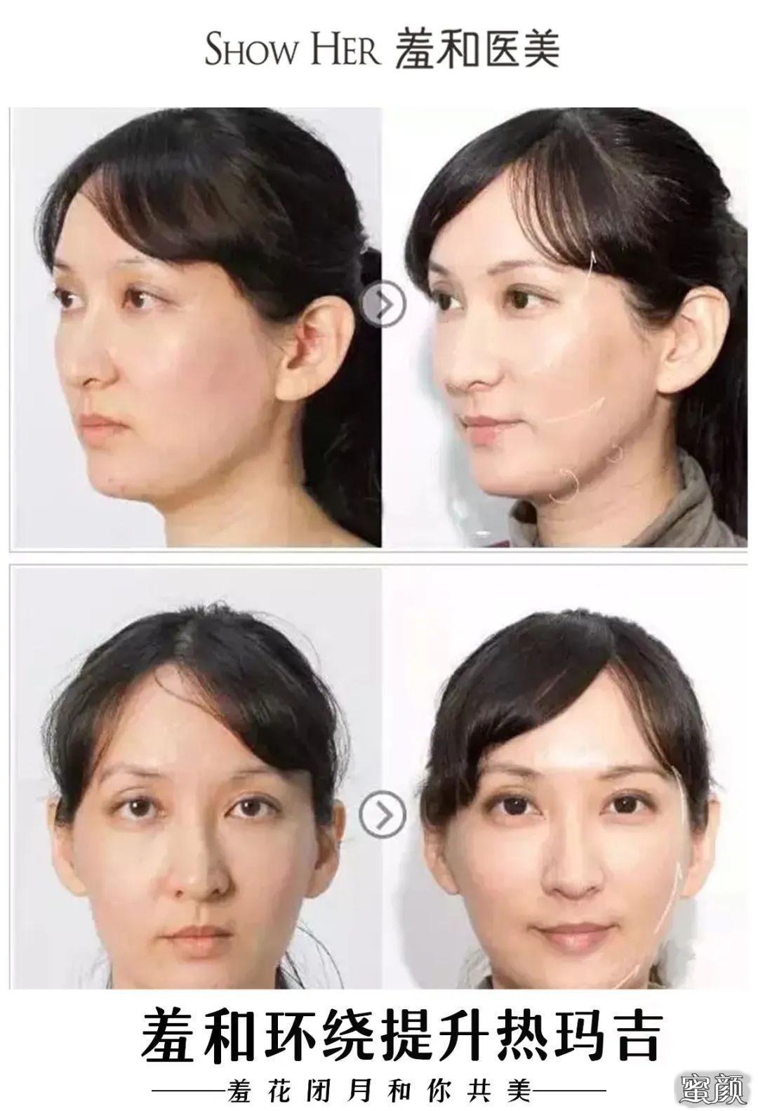 案例图片