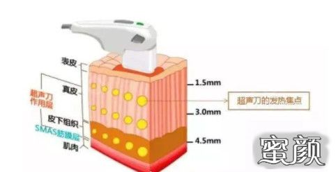 https://img.yiyiaimei.com/mnt/timg/200722/16140K648-5.jpg 案例图片