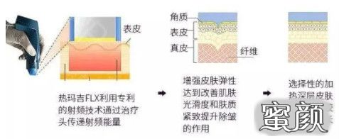 https://img.yiyiaimei.com/mnt/timg/200722/16140Kb4-4.jpg 案例图片