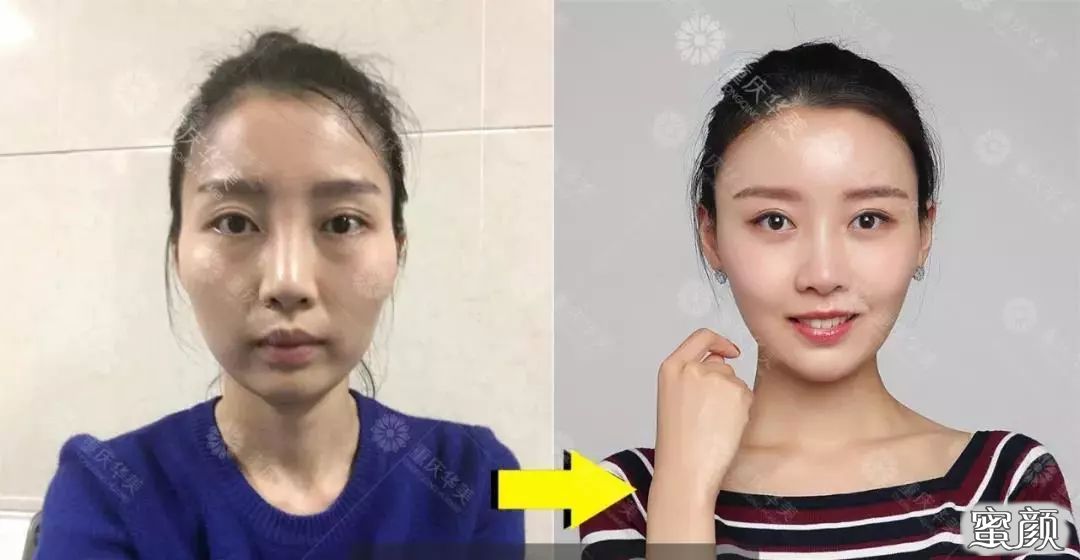 案例图片