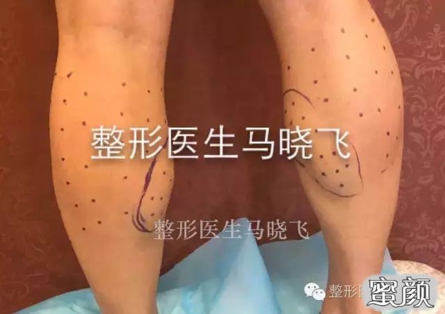https://img.yiyiaimei.com/mnt/timg/200723/11445CS9-3.jpg