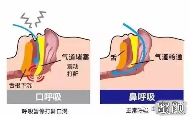 案例图片