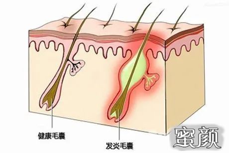 案例图片