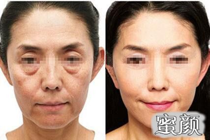 https://img.yiyiaimei.com/mnt/timg/200724/12544212R-0.jpg