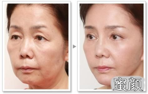 https://img.yiyiaimei.com/mnt/timg/200724/1254442S8-1.jpg