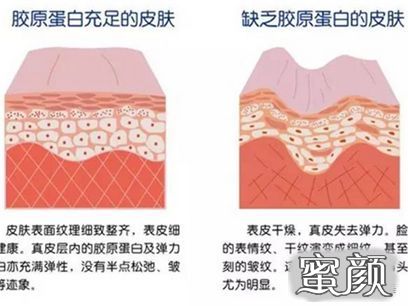 https://img.yiyiaimei.com/mnt/timg/200724/1254463551-7.jpg