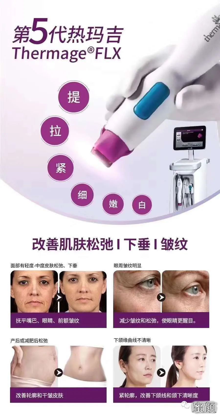 案例图片