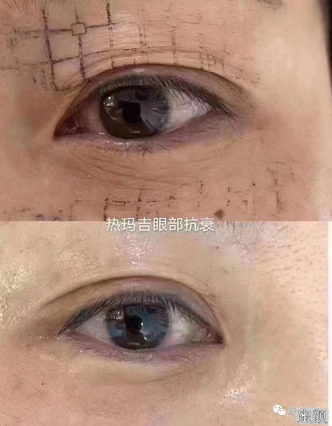案例图片