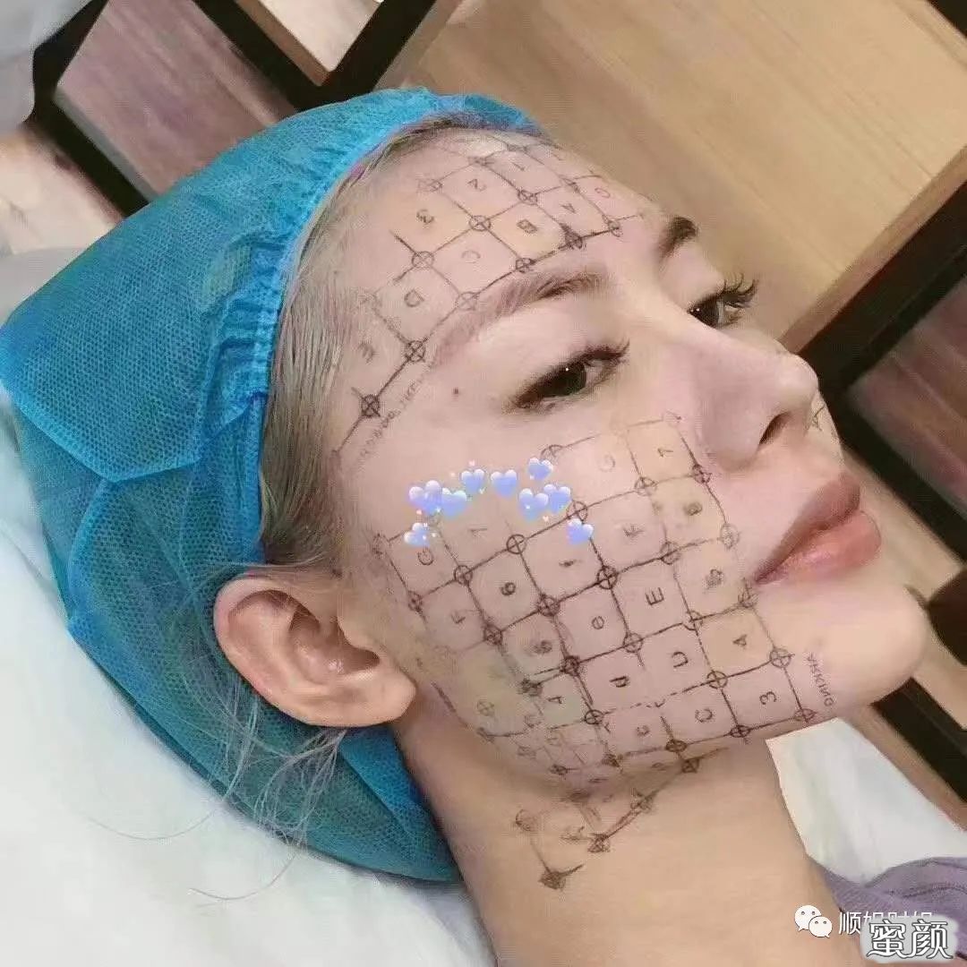 案例图片
