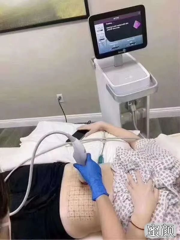 案例图片