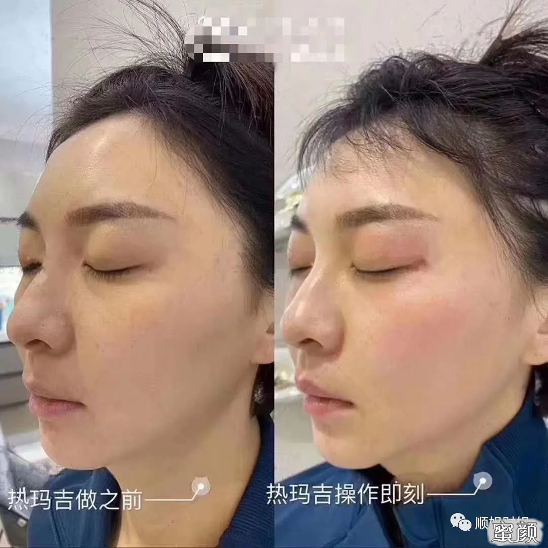 案例图片