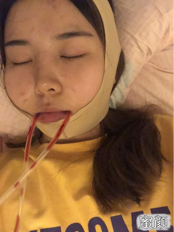 https://img.yiyiaimei.com/mnt/timg/200724/13510H028-1.jpg