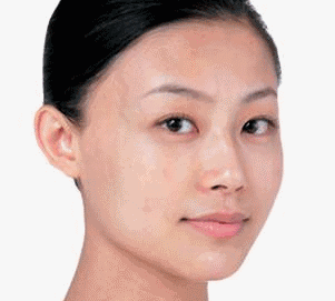 https://img.yiyiaimei.com/mnt/timg/200725/132211B47-1.jpg 案例图片