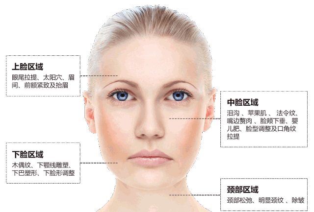 https://img.yiyiaimei.com/mnt/timg/200725/1322392304-4.jpg 案例图片