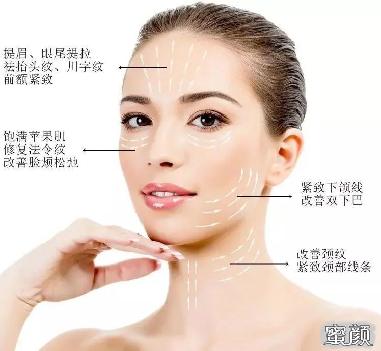 https://img.yiyiaimei.com/mnt/timg/200725/13223WB6-3.jpg 案例图片