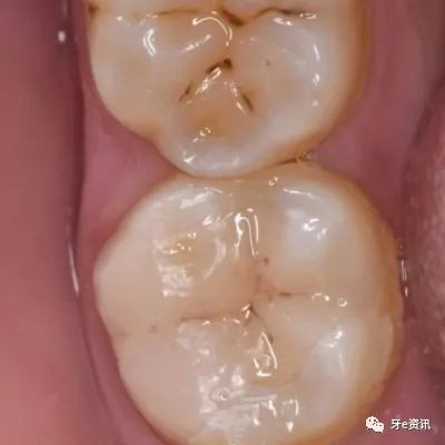 案例图片