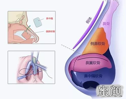 案例图片