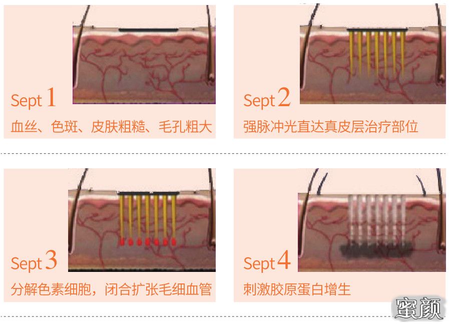 案例图片