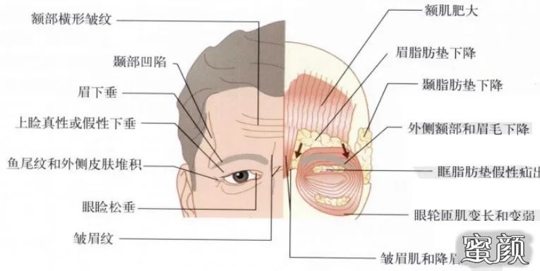 案例图片