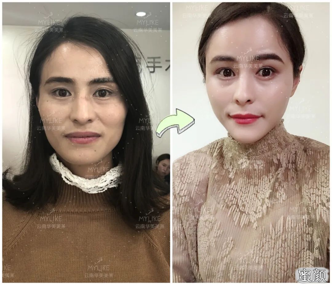 案例图片