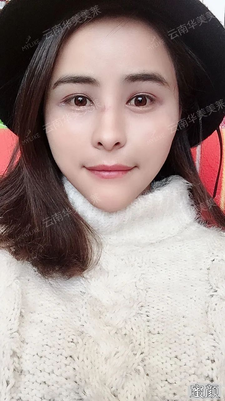 案例图片