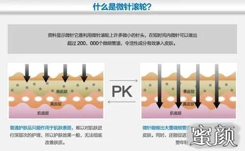 案例图片