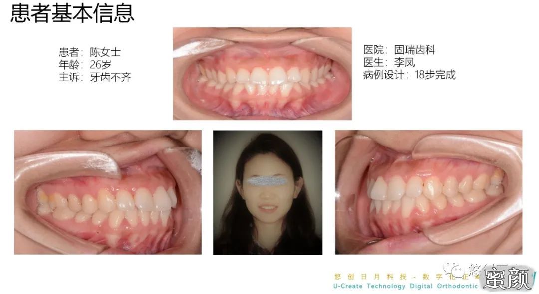 案例图片