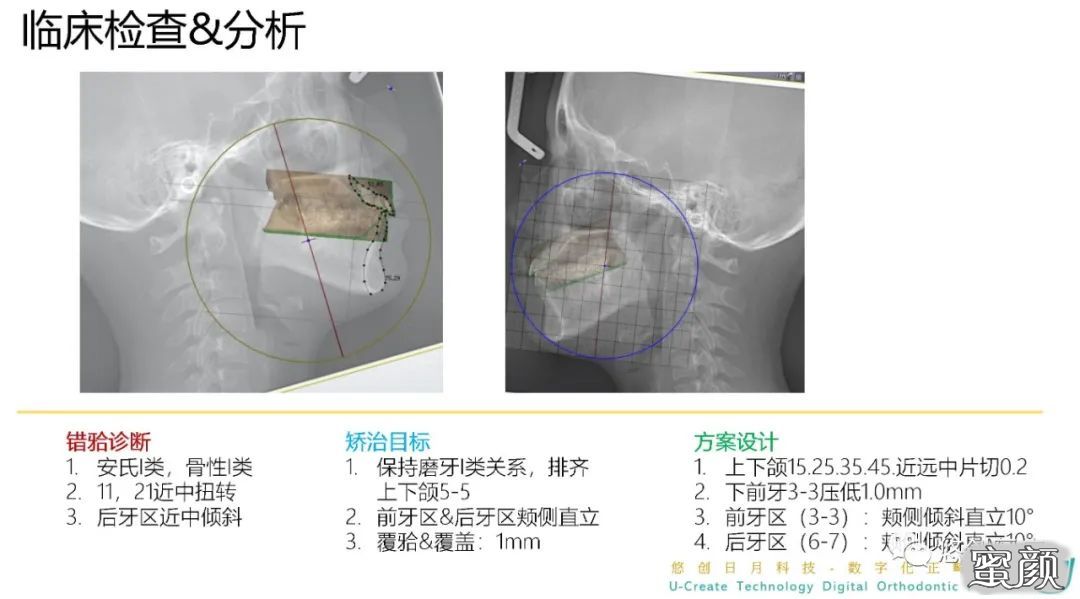 案例图片