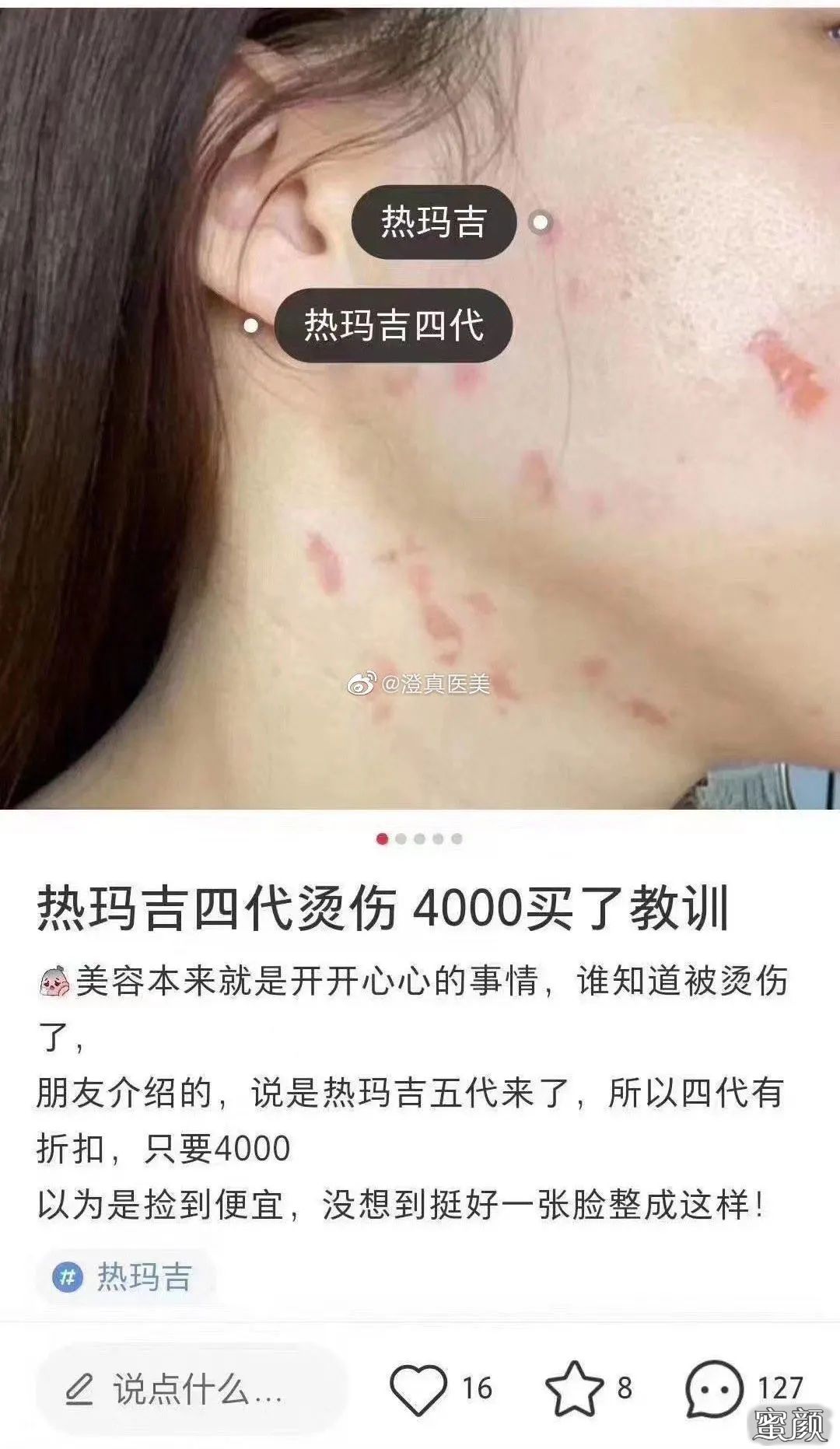 案例图片