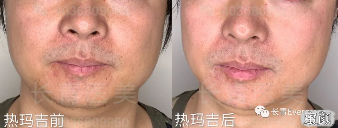 案例图片