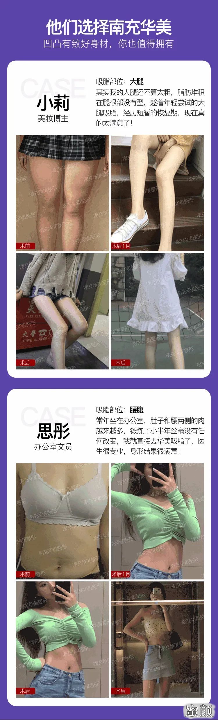 https://img.yiyiaimei.com/mnt/timg/200728/1504112521-1.jpg 案例图片