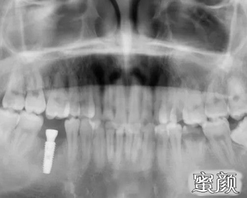 案例图片