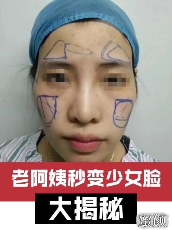 https://img.yiyiaimei.com/mnt/timg/200729/1042552114-0.jpg