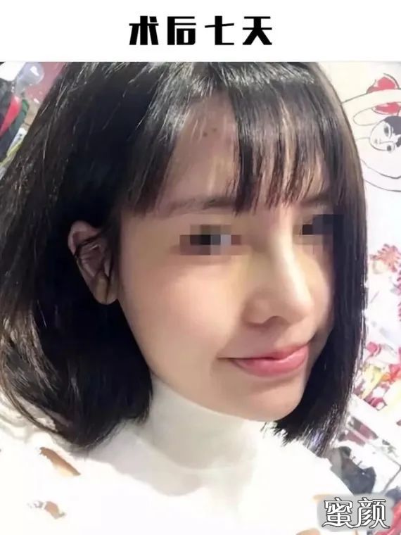 https://img.yiyiaimei.com/mnt/timg/200729/1042556123-2.jpg